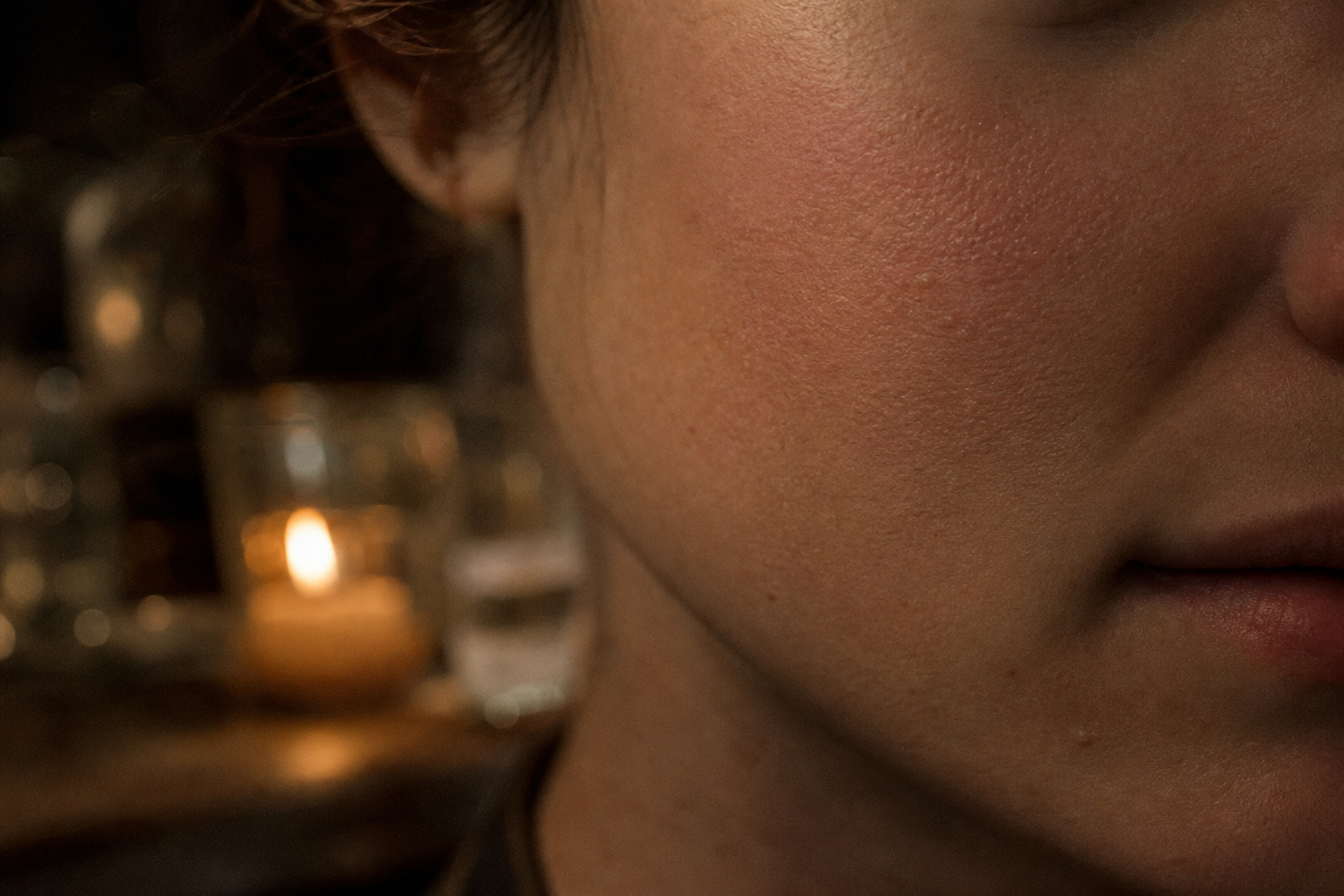 Papulopustular Rosacea or Hormonal Acne: The Log That Separates Them